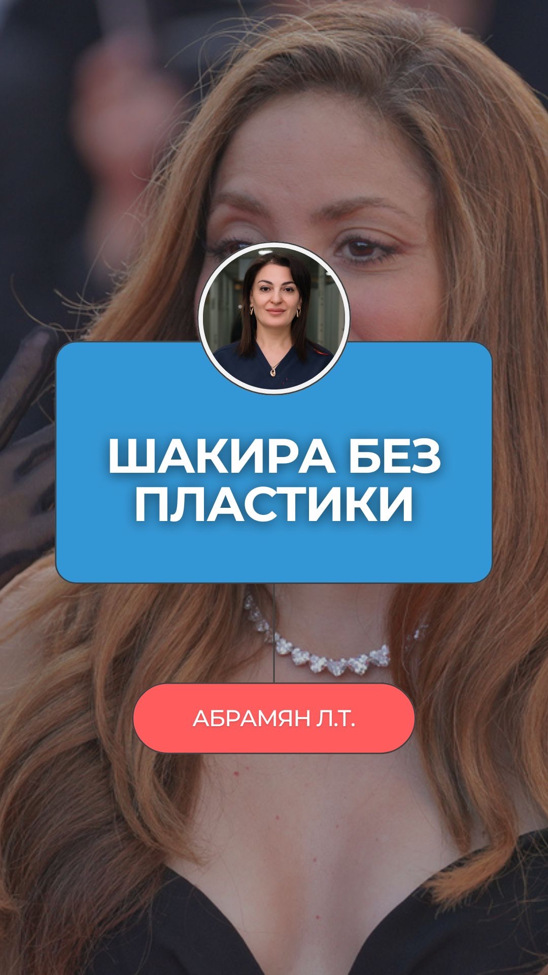  Шакире 47. Четверо детей. Все думают  пластика. А я вижу совсем другое!