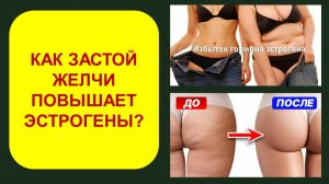 Как застой желчи повышает эстрогены?