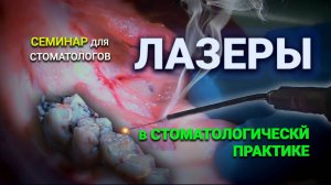 Лазеры в стоматологической практике. Семинар для стоматологов #лазеры
