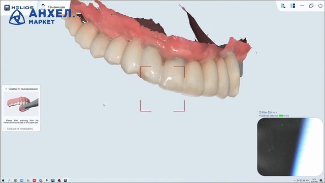 Технология внутриротовой фотограмметрии IPG Helios Orion system
