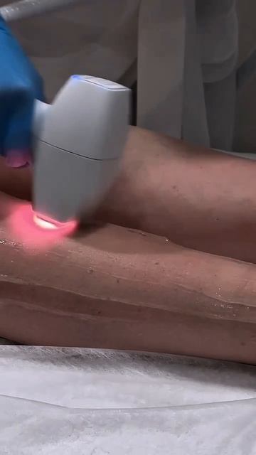 ЛАЗЕРНАЯ ЭПИЛЯЦИЯ В КЛИНИКЕ КОСМЕТОЛОГИИ МОЛОДОСТЬ