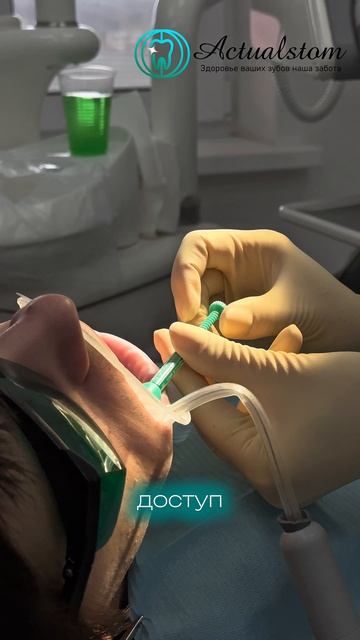 Инновационная технология ICON в Актуалстом