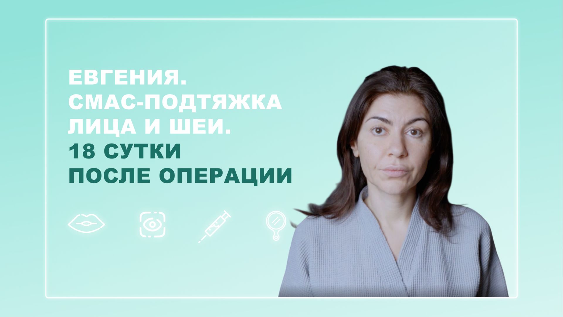 Евгения. СМАС-подтяжка лица и шеи. 18 сутки после операции