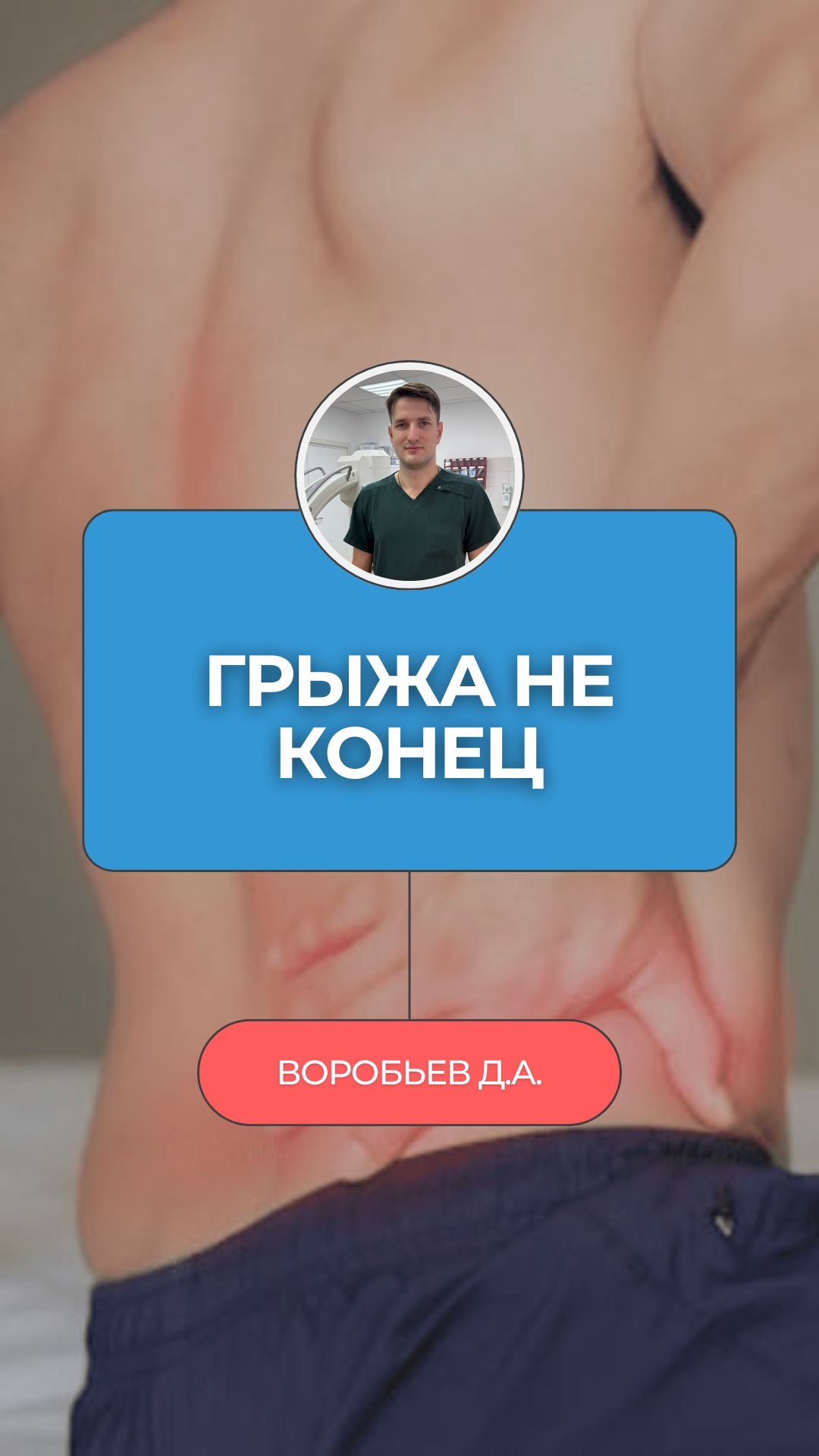 🚫 Грыжа — это операция. Блокада — это больно. МРТ чистое — ты здоров. Всё это мифы!