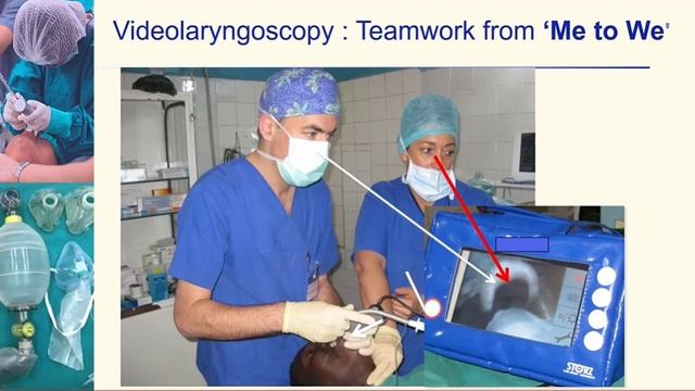 L.05.02 Airway Management