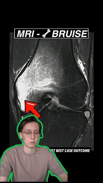 Энтони Эдвардс и травма колена  Плей-офф НБА 2026