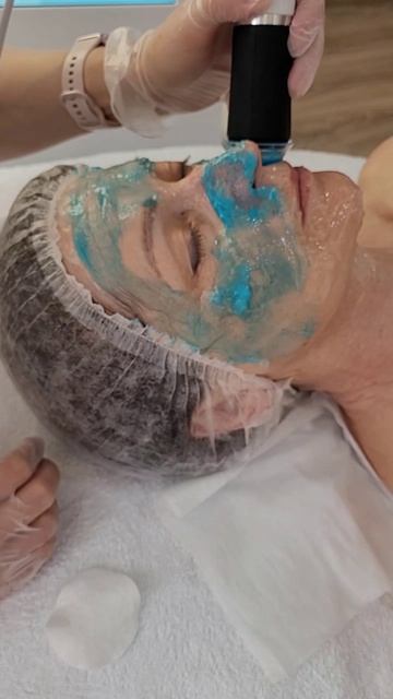 Карбокси омоложение без уколов