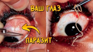 [Звёздный Капитан] - Этот паразит живёт в ваших глазах