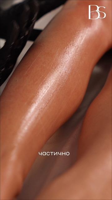 Почему нельзя пользоваться кремом или дезодорантом перед лазерной эпиляцией?