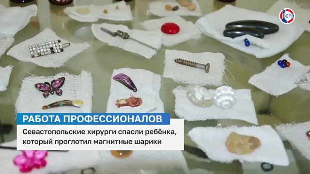 Севастопольские хирурги спасли ребёнка, который проглотил магнитные шарики