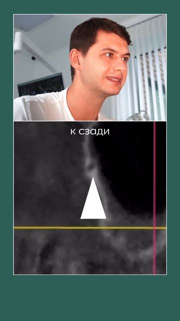Как по данным КТ найти артерию синуса?