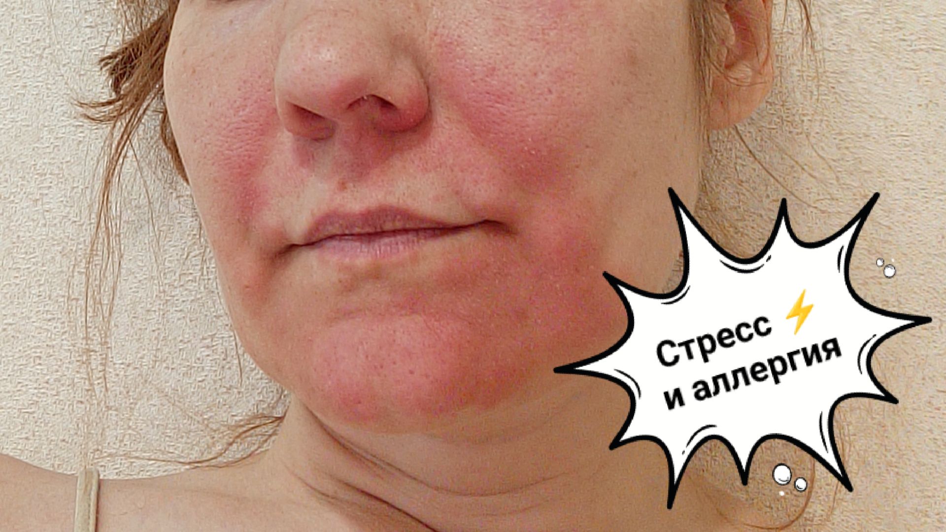 Снова траты денег  Заболела из-за стресса 