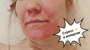 Снова траты денег 💰 Заболела из-за стресса 😢