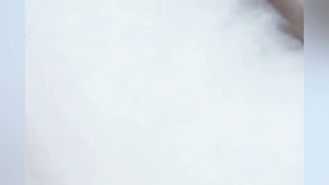 Выдавливание прыщей угрей черных точек и камедонов 401