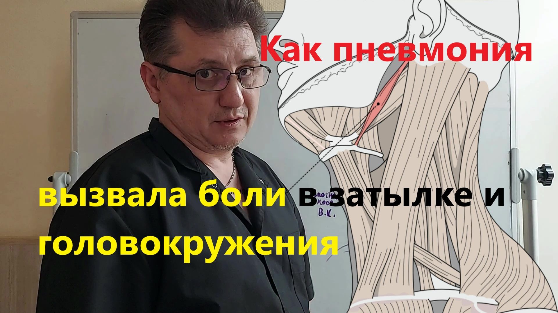 Интересное из остеопатической практики - 6. Болит затылок смотри бронх.