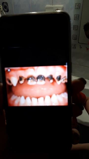 Как заставить ребёнка чистить зубы