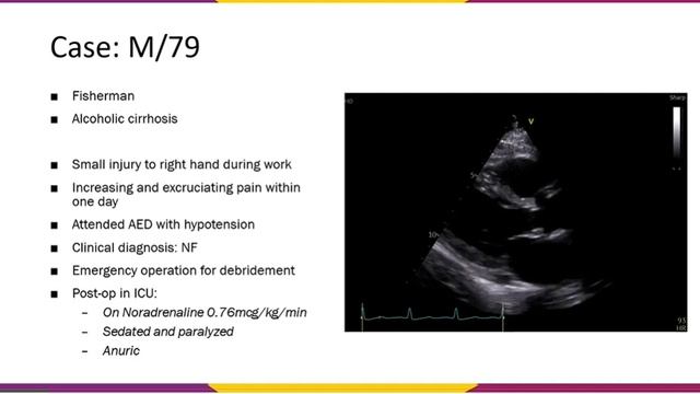 L.04.05 Vasopressors And Inotropes In Septic Shock - New Directions
