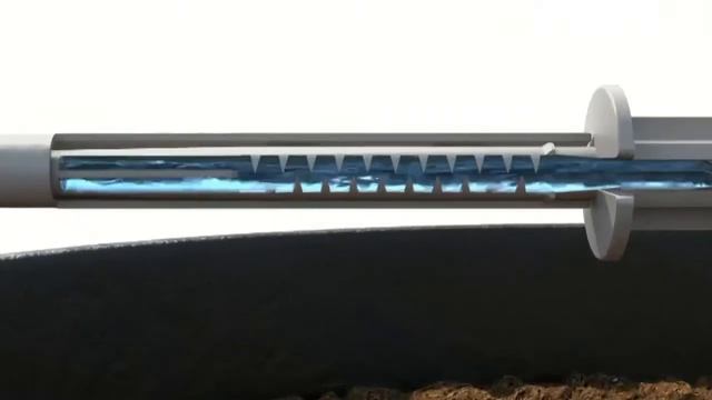 Установка Внешняя капельница