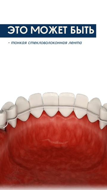 Лучшии способ спасти шатающиеся зубы