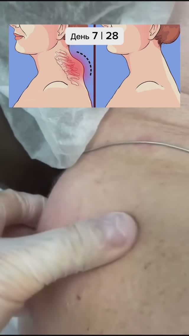 ЧЕЛЛЕНДЖ «КОРОЛЕВСКАЯ ОСАНКА» ДЕНЬ 7