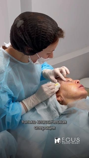 Нитевой лифтинг. Часть 2