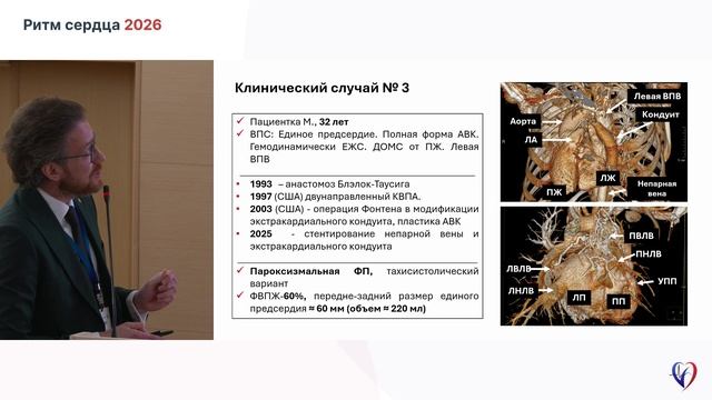005 Романов Александр Борисович «Роботизированное лечение фибрилляции предсердийzal1