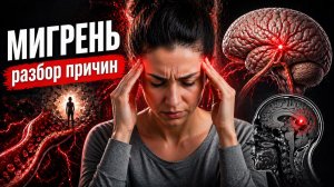 МИГРЕНЬ. РАЗБОР ПРИЧИН