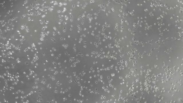 Визуализация клеток рака молочной железы