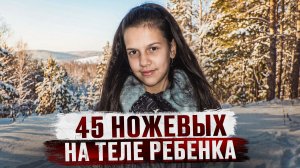 НА НЕЙ НЕ БЫЛО ЖИВОГО МЕСТА - Самое жестокое дело Саратова | Ильнара Ягудина