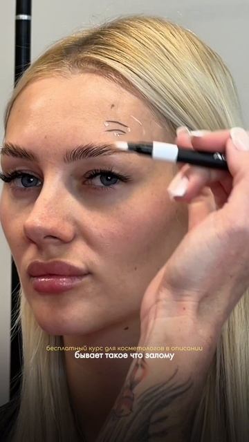 Морщины после ботокса