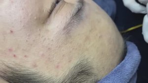 111 • Acne collection • АСМР • Relax Spa