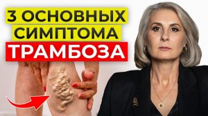 ЭТИ признаки тромбоза нельзя игнорировать! / Как ИЗБЕЖАТЬ инфаркта и инсульта?