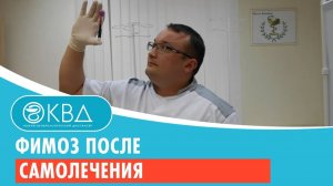 Фимоз после самолечения. Клинический случай №70