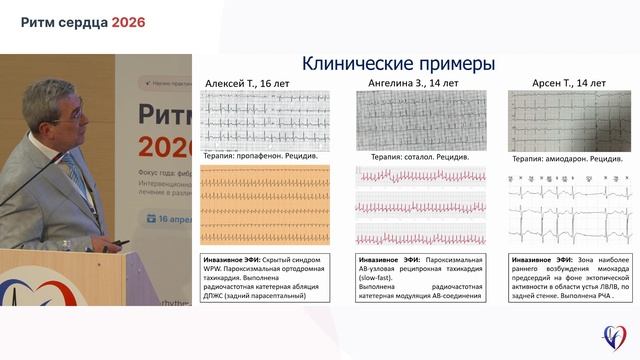 011 Термосесов Сергей Артурович «Фибрилляция предсердий у детей»zal1