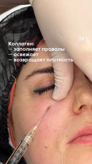 Думаете, можно просто уколоть губы и выглядеть свежо? Это не так 🥲