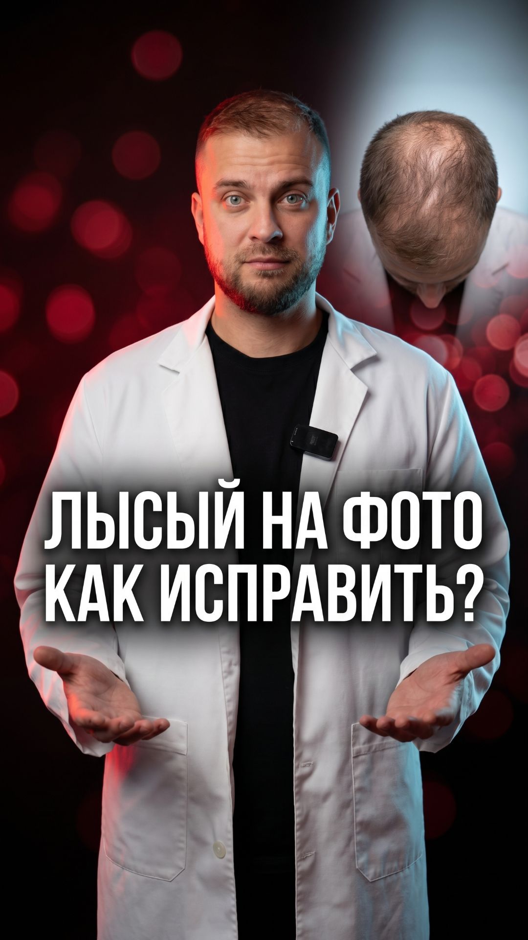 Три мифа об облысении которые работают против вас