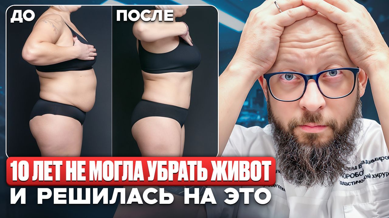 10 лет борьбы с животом и операция, которая изменила ВСЕ