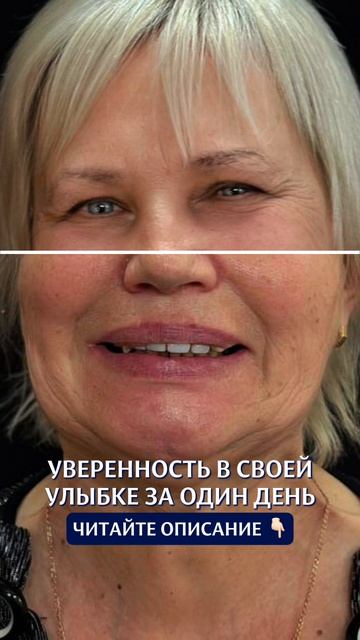 Кейс пациента