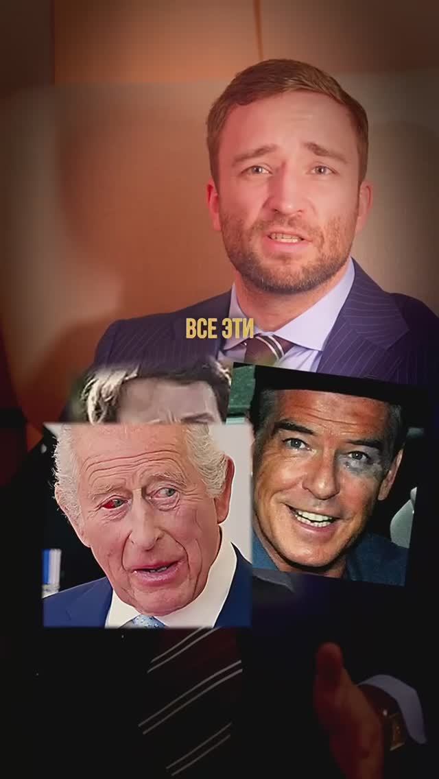 Синяки у политиков - раскрываем суть явления !