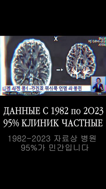 'МЕДИЦИНСКАЯ СУПЕР КОРПОРАЦИЯ' '의료 슈퍼 대기업' ЭКОНОМИКА #корея