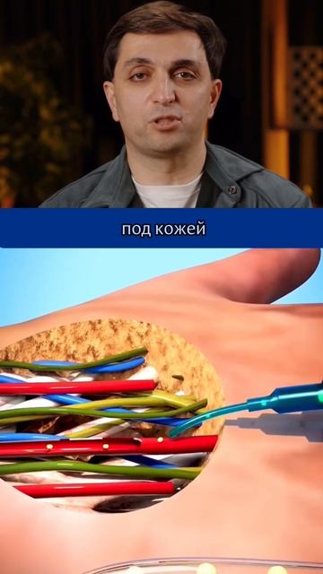 Почему медсестры так часто проверяют катетер на капельницах