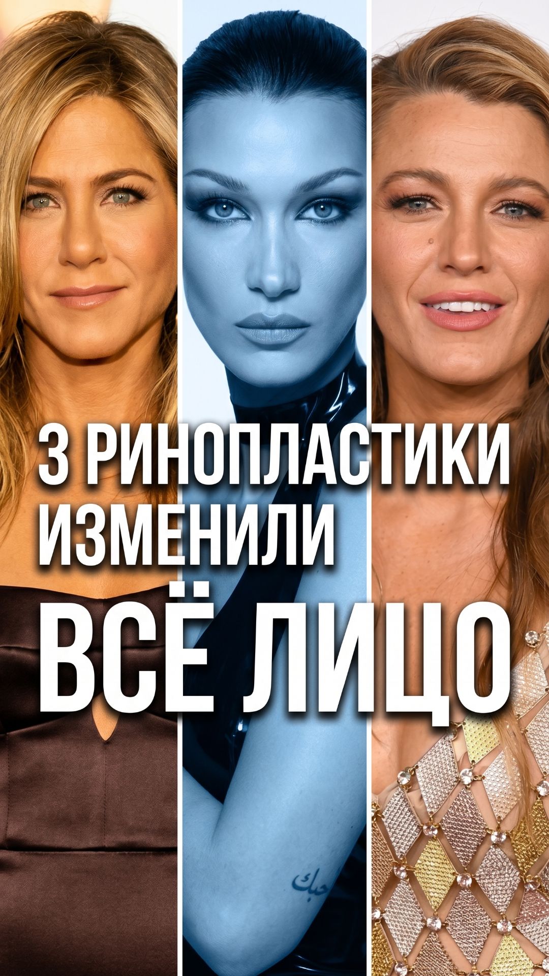 Три ринопластики которые изменили всё лицо — Лайвли Хадид Энистон. Хирург объясняет почему.