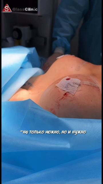 Подтяжка груди без имплантов , результат сразу после операции