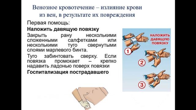 Белан А.И. Оказание первой помощи. Перелом. Кровотечение