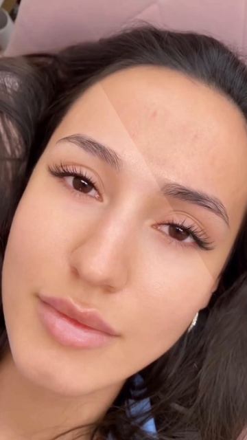 Идеальная кожа клиента за один клик!