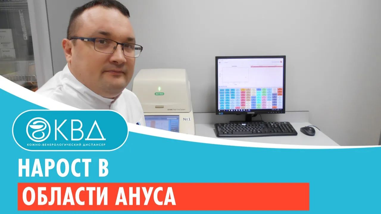 Нарост в области ануса. Клинический случай №67