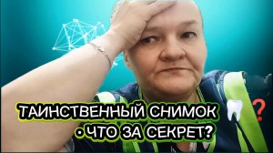 Зубы: новый поворот. Загадочный снимок для имплантации — «нужен и всё, но какой — не сказали».