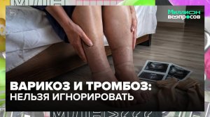 Следы от носков, отёки и судороги: когда пора к флебологу | Миллион вопросов — Москва 24