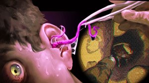 Чистить уши оказалось страшным делом - Tiny Chills Not From Ear