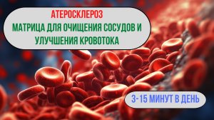 Атеросклероз: матрица для очищения сосудов и артерий ❤️